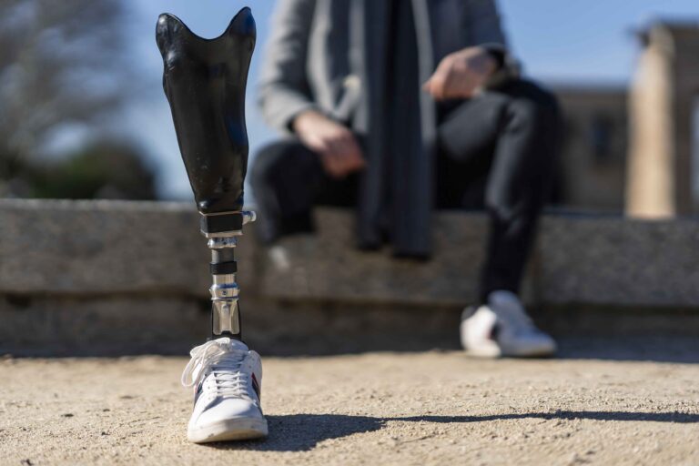 Wrong Size/Wrong Site Prosthesis for Joint Replacements